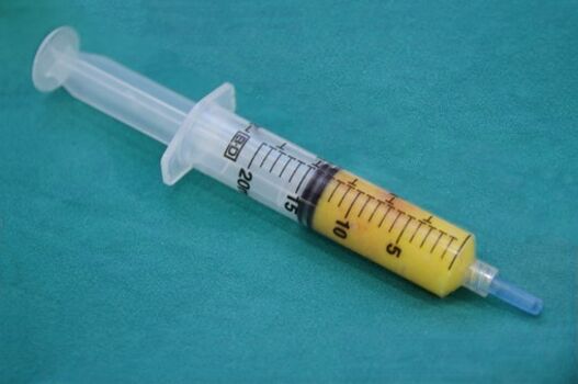 Stříkačka s tukovou tkání pro lipofilling
